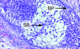 Detail ghost cell-tumor (1)