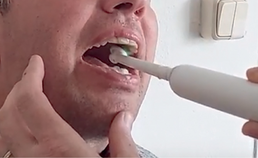 ALS-patiënt bij wie tanden worden gepoetst
