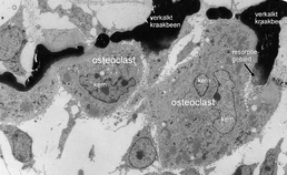Collageenafbraak door fibroblasten en osteoclasten