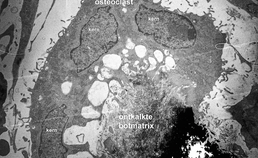 Collageenafbraak door fibroblasten en osteoclasten