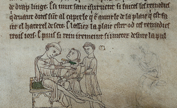 Middeleeuwse tandheelkunde in de Lage Landen 8. “Eenre vrouw die hadde squinantie”