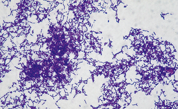 Aggregatie van Streptococcus gordonii door speeksel