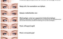 Oculaire bijwerkingen, symptomen