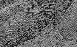 microplicae-structuur van onbestraalde mucosacel