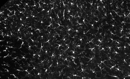 Rustende microgliale cellen