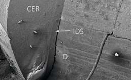IDS-dentine-grensvlak lithiumdislicaatkroon