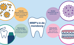 De rol van MMP's bij mondziekten en tandheelkundige behandelingen