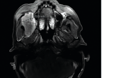 MRI met transversaal aanzicht