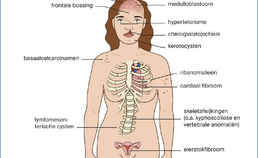 Klinische symptomen van het basaalcelnaevussyndroom