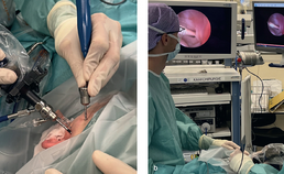 Artroscopische chirurgie onder algehele anesthesie