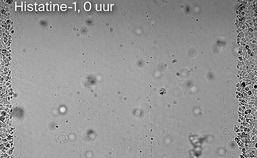 Experiment groei epitheelcellen met histatine, 0 uur