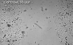 Experiment groei epitheelcellen zonder histatine, 18 uur