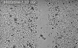 Experiment groei epitheelcellen met histatine, 18 uur