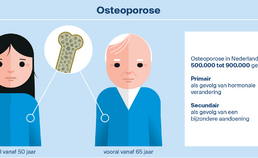 Osteoporose in Nederland