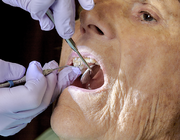 Algemene gezondheid, zorgkosten en tandartsbezoek van ouderen met verschillende orale status