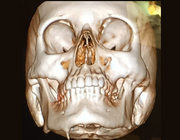 Serie: Hora est. Het gebruik van parodontale-ligamentfibroblasten in onderzoek naar fibrodysplasia ossificans progressiva