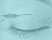 Cosmetische aangezichtschirurgie: wat je als tandarts moet weten 