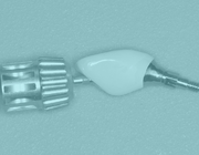 Abutmentselectie in de implantologie: kleine onderdelen, grote impact