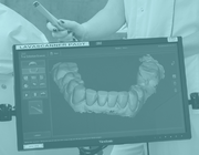 Digitale tandheelkunde vanuit restauratief en prothetisch oogpunt