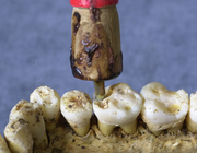 Tanden des tijds: onderzoek van gebitten en tanden uit archeologische opgravingen