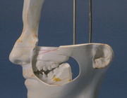 Serie: Tandheelkundig erfgoed.Het extractiedebat: orthodontie in Nederland aan het begin van de twintigste eeuw
