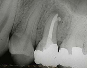 Cariologie en restauratieve tandheelkunde