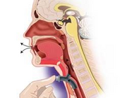 Spraakrevalidatie na een totale laryngectomie