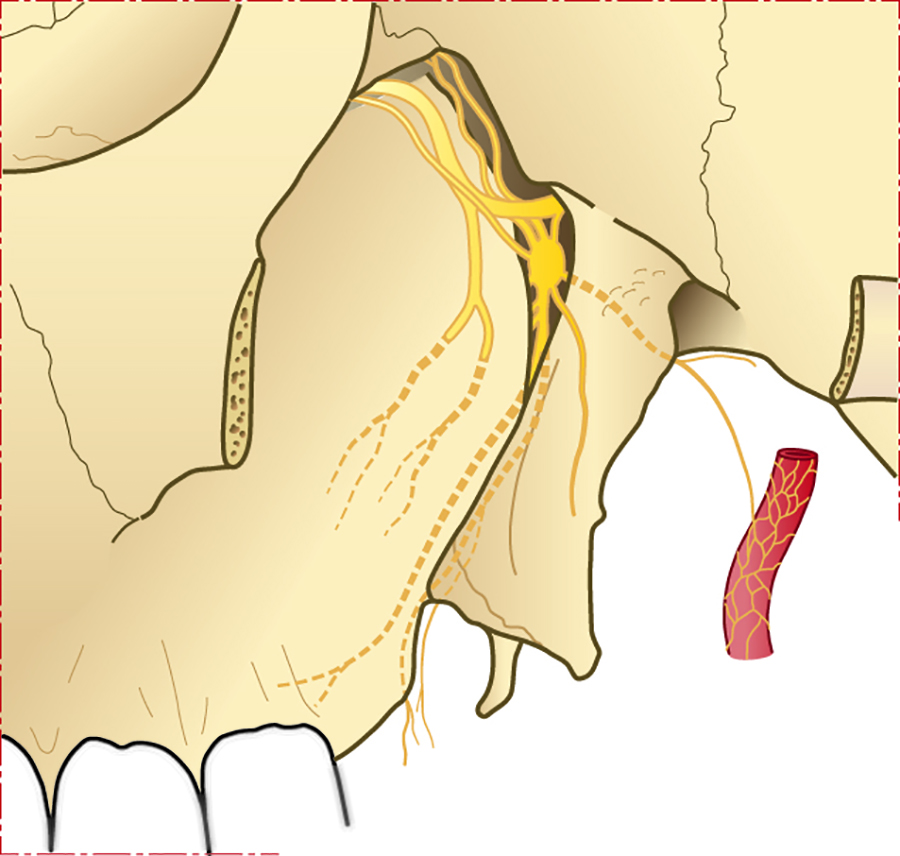 Afb.  1. Anatomie van het ganglion sphenopalatiunum (Illustrator: Frans Hessels)