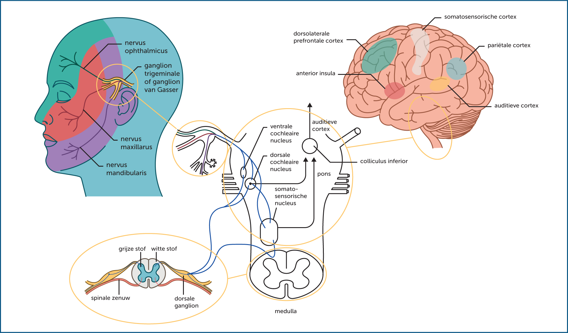 Somatische tinnitus