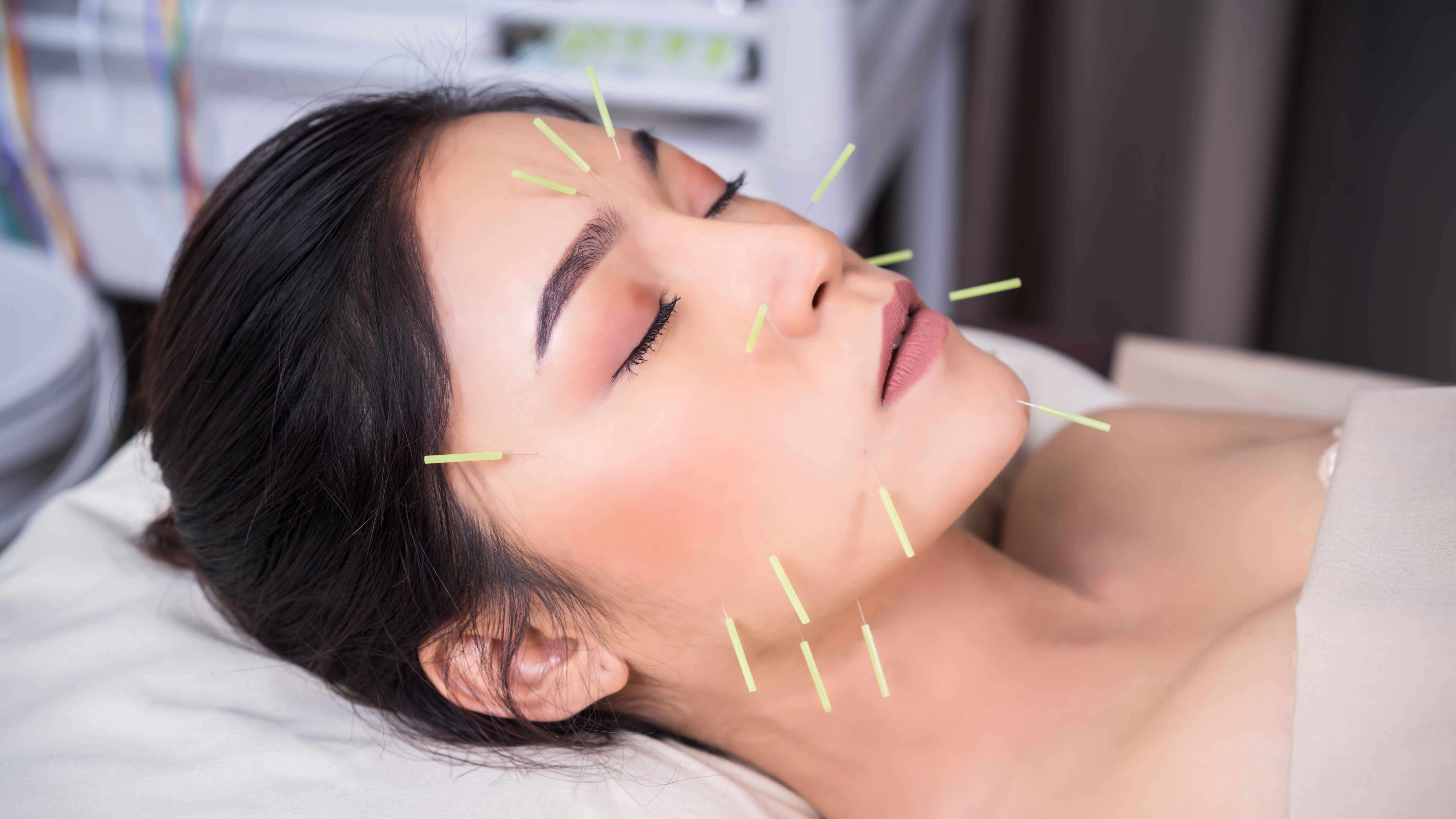 Helpt acupunctuur bij een droge mond?