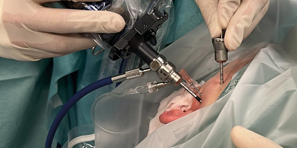 Minimaal invasieve behandelingen en opengewrichtschirurgie voor aandoeningen van het kaakgewricht