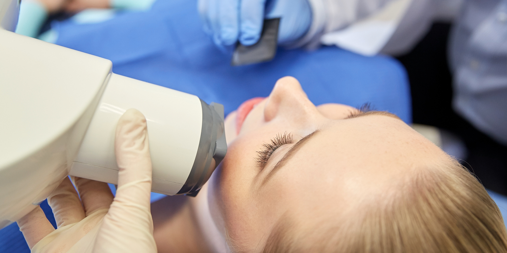 Radiotherapie hoofd-halsgebied leidt tot gingivarecessie en cariës