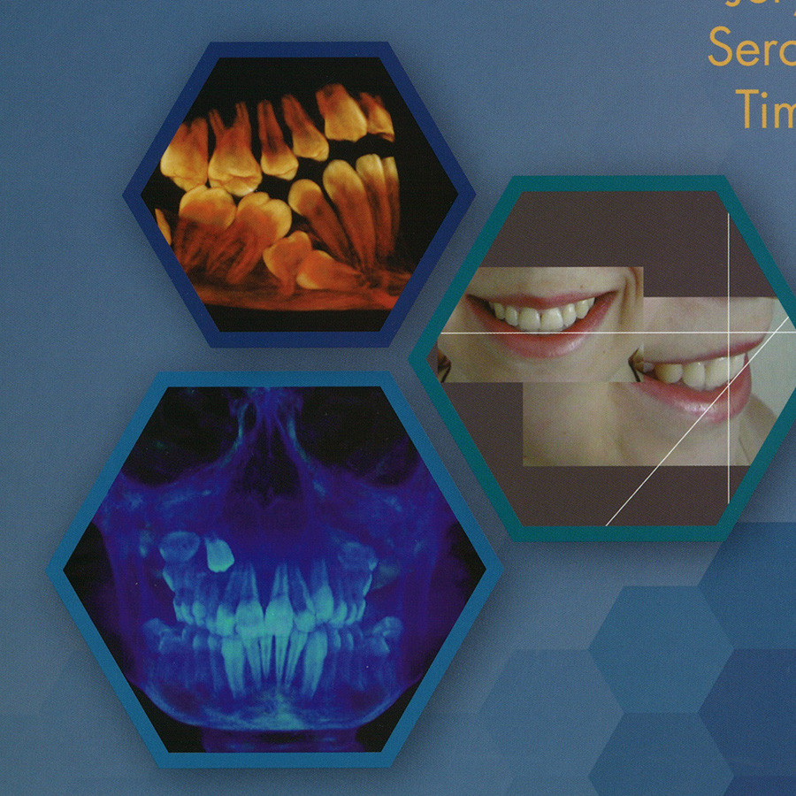 Brede beschrijving van de klinische orthodontie