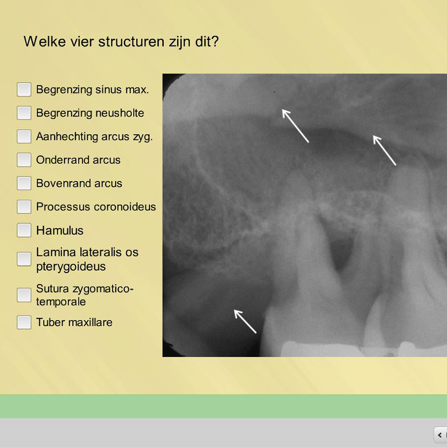 Scholing in de tandheelkundige radiologie