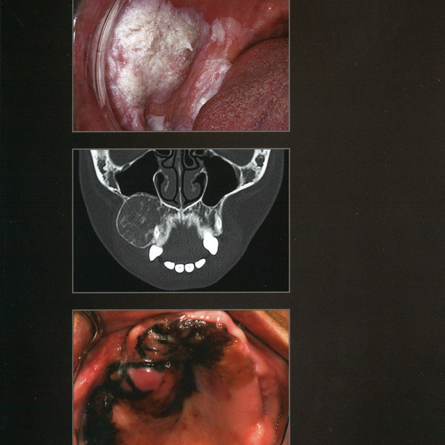 Oromaxillofaciale pathologie