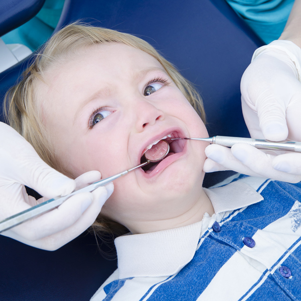 Tandheelkundige behandeling van angstige kinderen: belijden, vermijden of begeleiden?