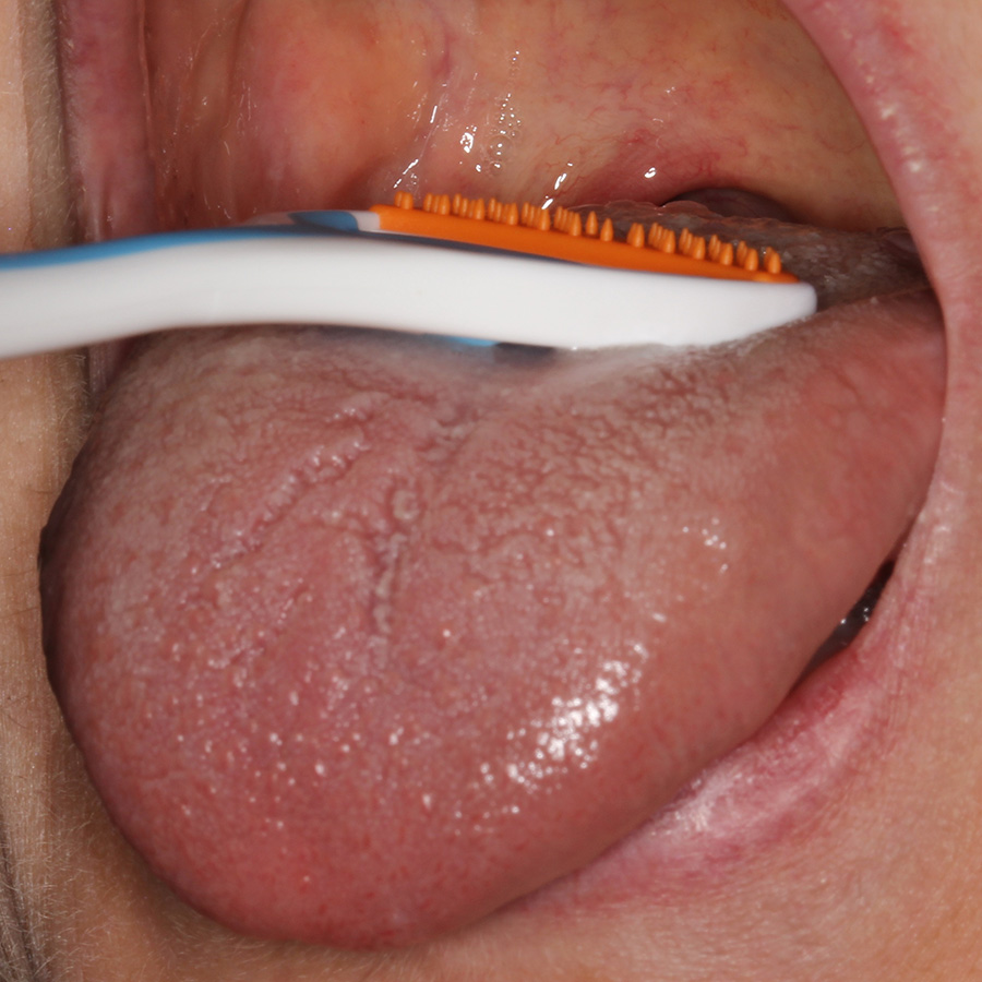Preventieve tandheelkunde 7. Halitose de mond uit helpen