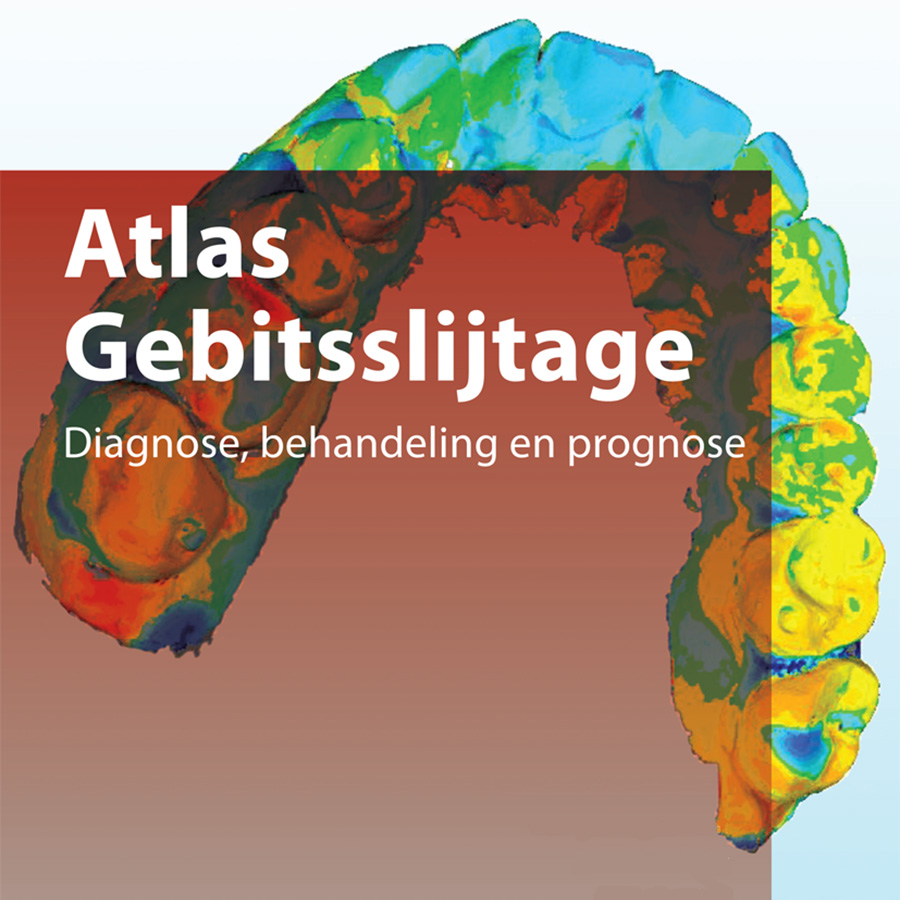 Atlas over gebitsslijtage