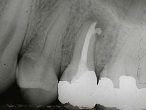 Cariologie en restauratieve tandheelkunde
