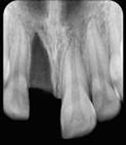 Dental trauma guide