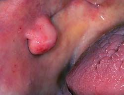 Verwijzing van patiënten met niet-odontogene mondaandoeningen naar een mond-, kaak- en aangezichtschirurg