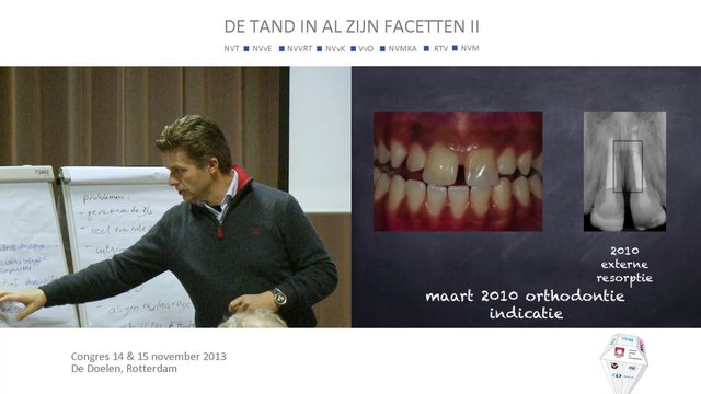De tand in al zijn facetten: casus 0-18 jaar. Oplossingen congresdeelnemers