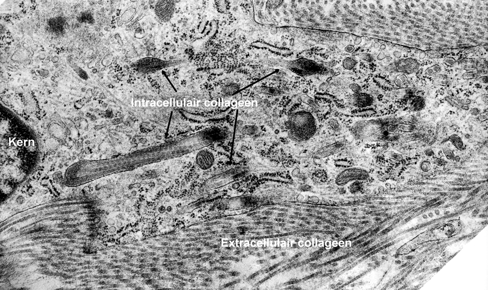 Collageenafbraak door fibroblasten en osteoclasten