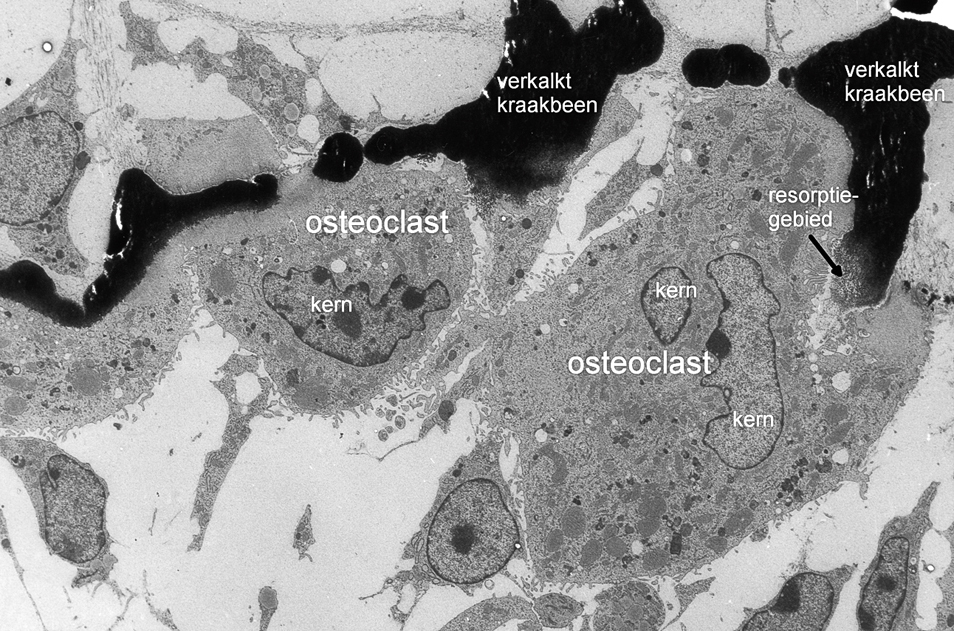 Collageenafbraak door fibroblasten en osteoclasten