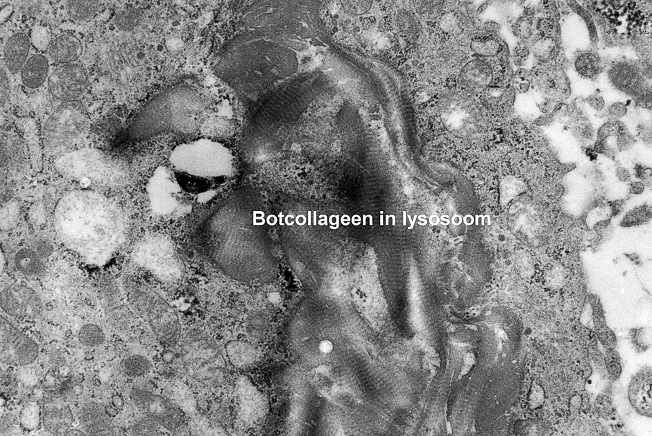 Collageenafbraak door fibroblasten en osteoclasten