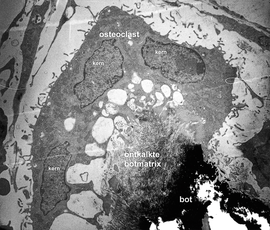 Collageenafbraak door fibroblasten en osteoclasten