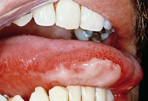 Odontogeen focusonderzoek: een voorstel voor een meer genuanceerde benadering