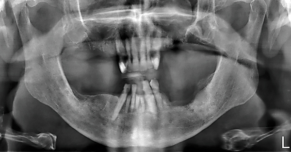 Odontogeen focusonderzoek: een voorstel voor een meer genuanceerde benadering