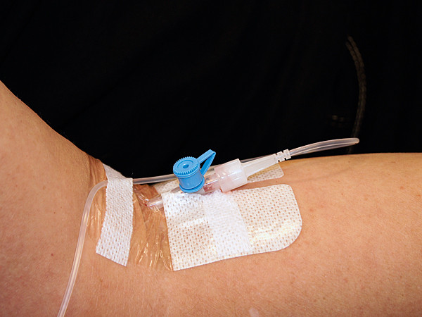 Lichte intraveneuze sedatie met midazolam door de tandarts