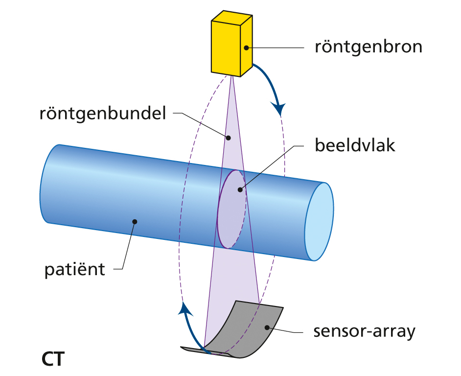 Principe van beeldvorming voor computertomografie